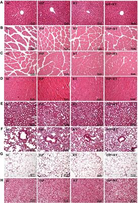 Isolated Soy Protein Supplementation Combined With Resistance Training Improves Muscle Strength, Mass, and Physical Performance of Aging Female Mice